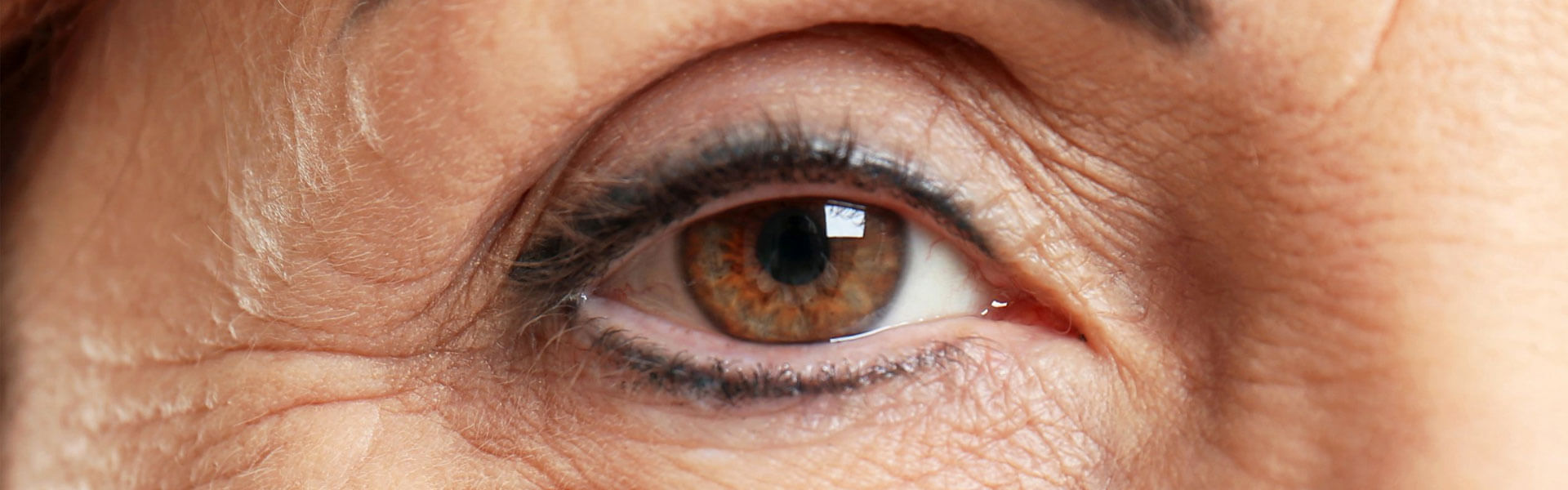 All You Need to Know About Cataract
